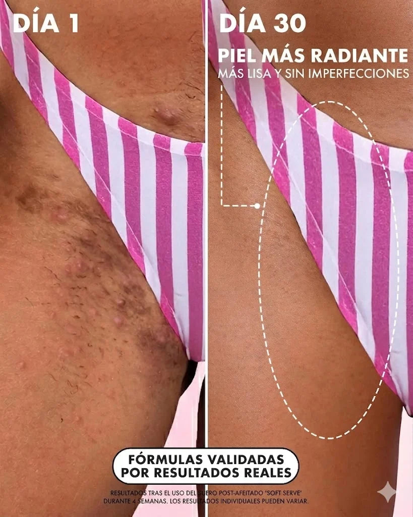 Día 1 y día 30 en zona del bikini